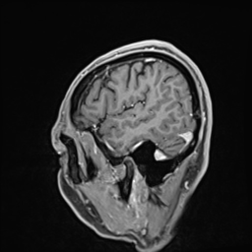 Click on the Serie image to view the images of VILLANUEVA, WILLIAM A.